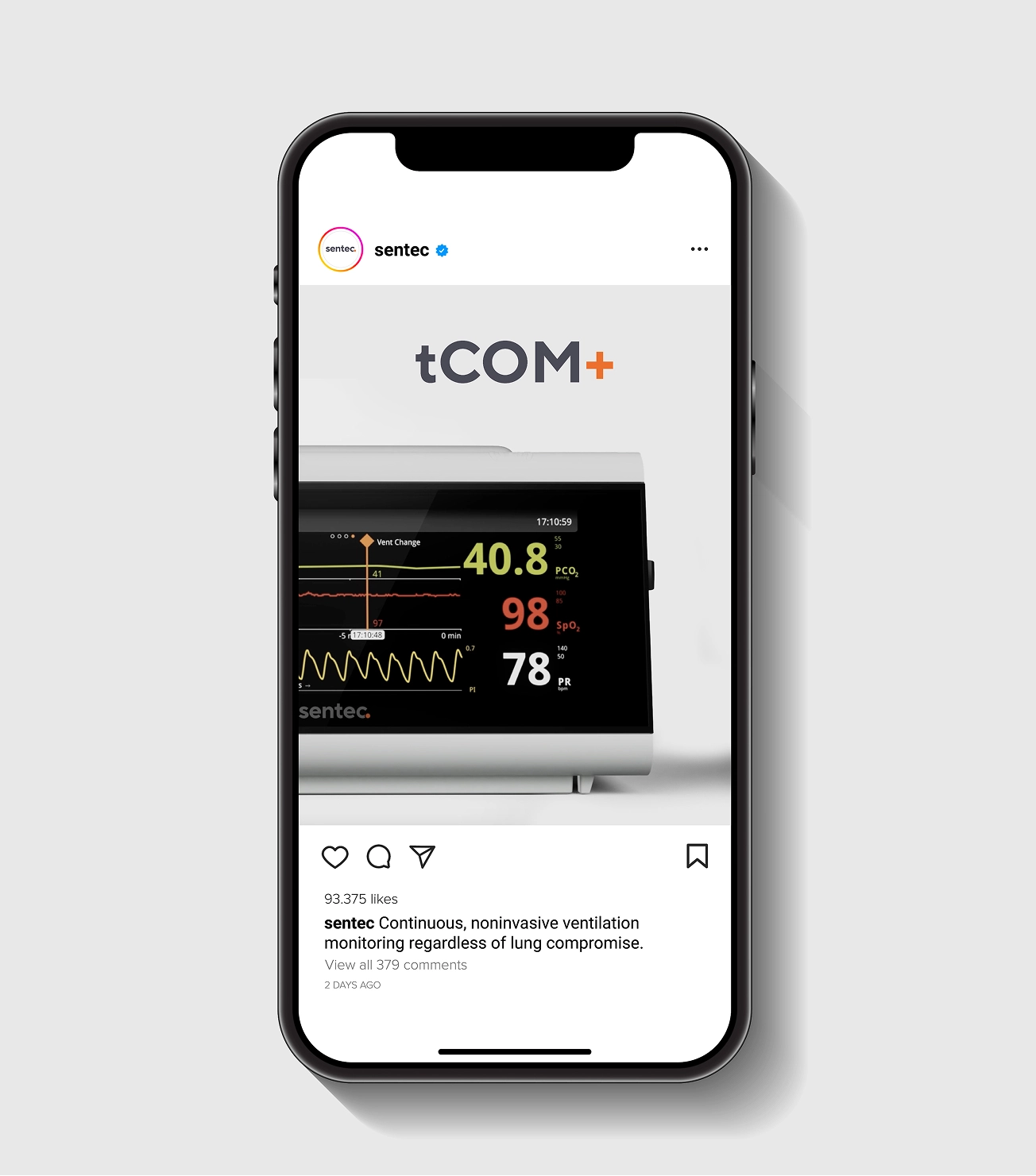 Smartphone displaying a Sentec social media post featuring the tCOM+ patient monitoring system, with live PCO₂, SpO₂, and pulse rate readings shown on the device screen.